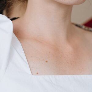 Comprar ecografía de cuello, ecografía de tiroides, eco de cuello.