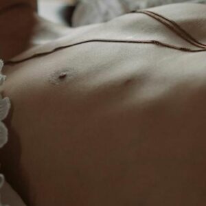 Ecografía Doppler Simple en Midiagnostico.