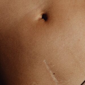 Radiografía de abdomen, rayos X de abdomen, radiografía abdominal, rayos X de abdomen.