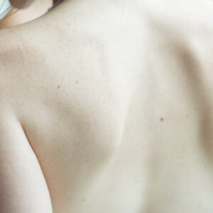 Comprar radiografía de columna, rayos x de columna, rayos x de columna vertebral, cervical o sacra.