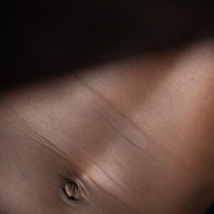 Resonancia magnética, RM de próstata, RM multiparamétrica de próstata, reso de próstata, resonancia de próstata.