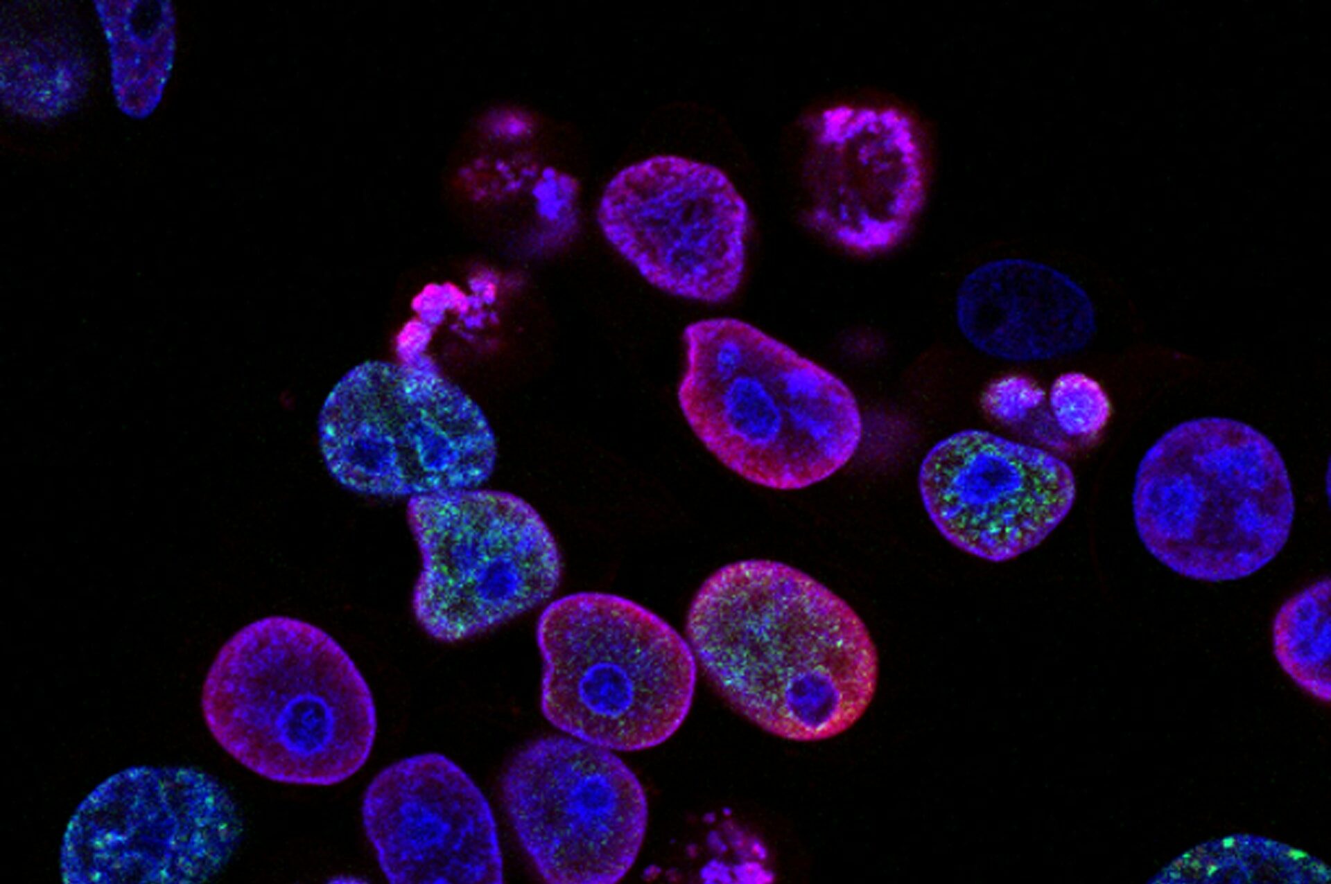 Comprar biopsia, cáncer, oncología, detección temprana de cáncer y más.