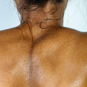 Comprar Estudio de Composición Corporal en MIDIAGNOSTICO.