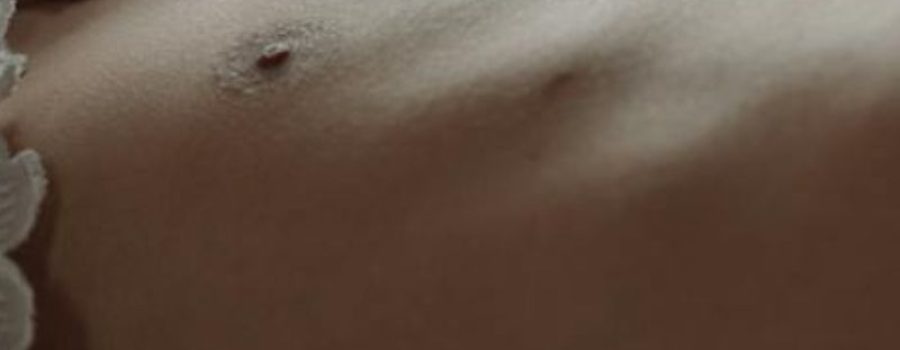 Ecografía Doppler Simple en Midiagnostico.