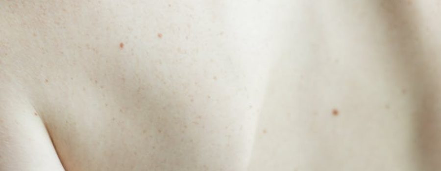 Comprar radiografía de columna, rayos x de columna, rayos x de columna vertebral, cervical o sacra.