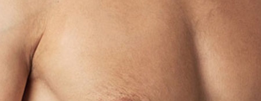 Comprar radiografía de tórax, radiografía torácica, rayos de tórax.