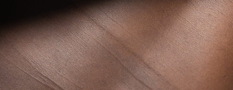 Resonancia magnética, RM de próstata, RM multiparamétrica de próstata, reso de próstata, resonancia de próstata.