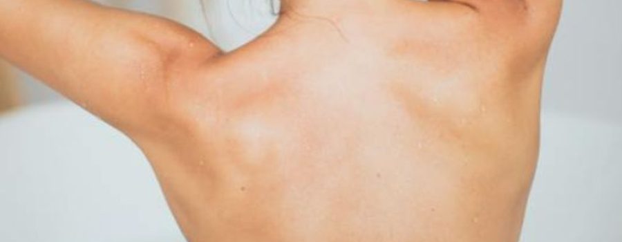 Comprar resonancia magnética, RM, resonancia de una región.