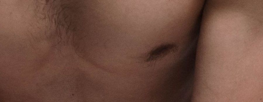 Comprar TAC torácico, TAC de tórax, TAC de la región torácica, TAC de pecho.